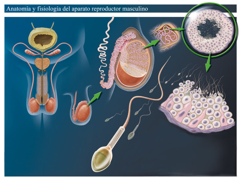 azoospermia obstructiva